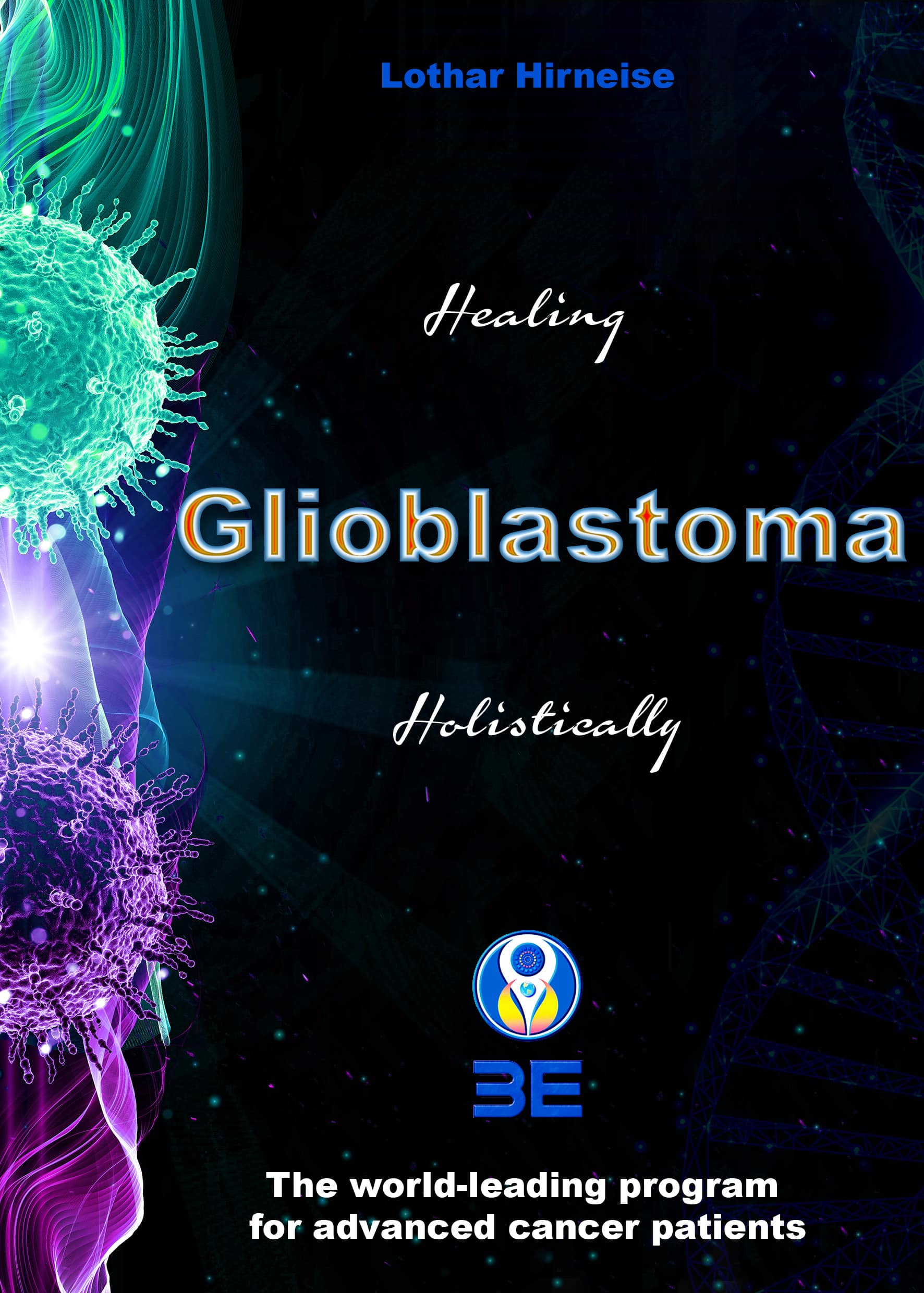 Glioblastoma 