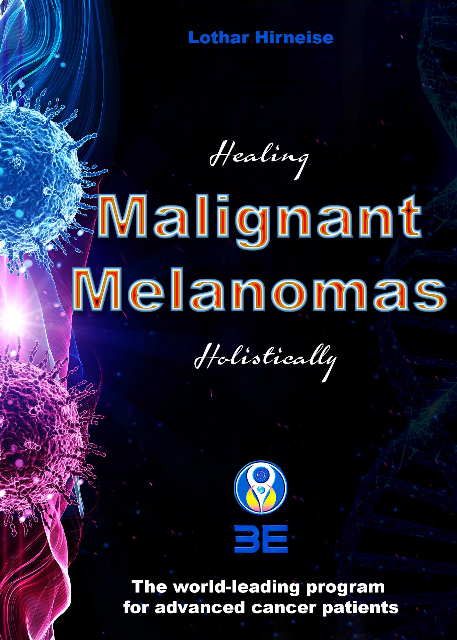 Malignant melanomas 