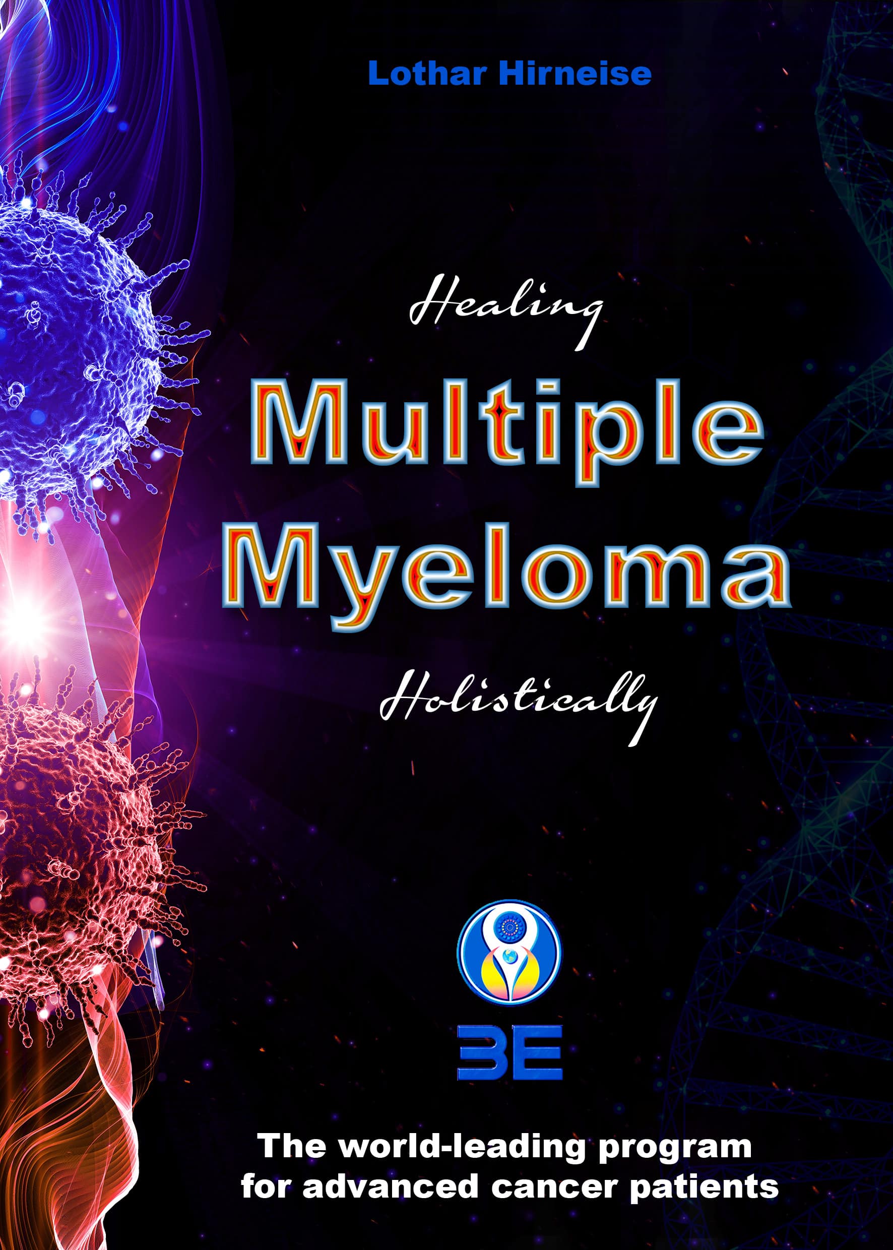 Multiple myeloma 