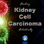 Kidney cell carcinoma
