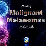 Malignant melanomas