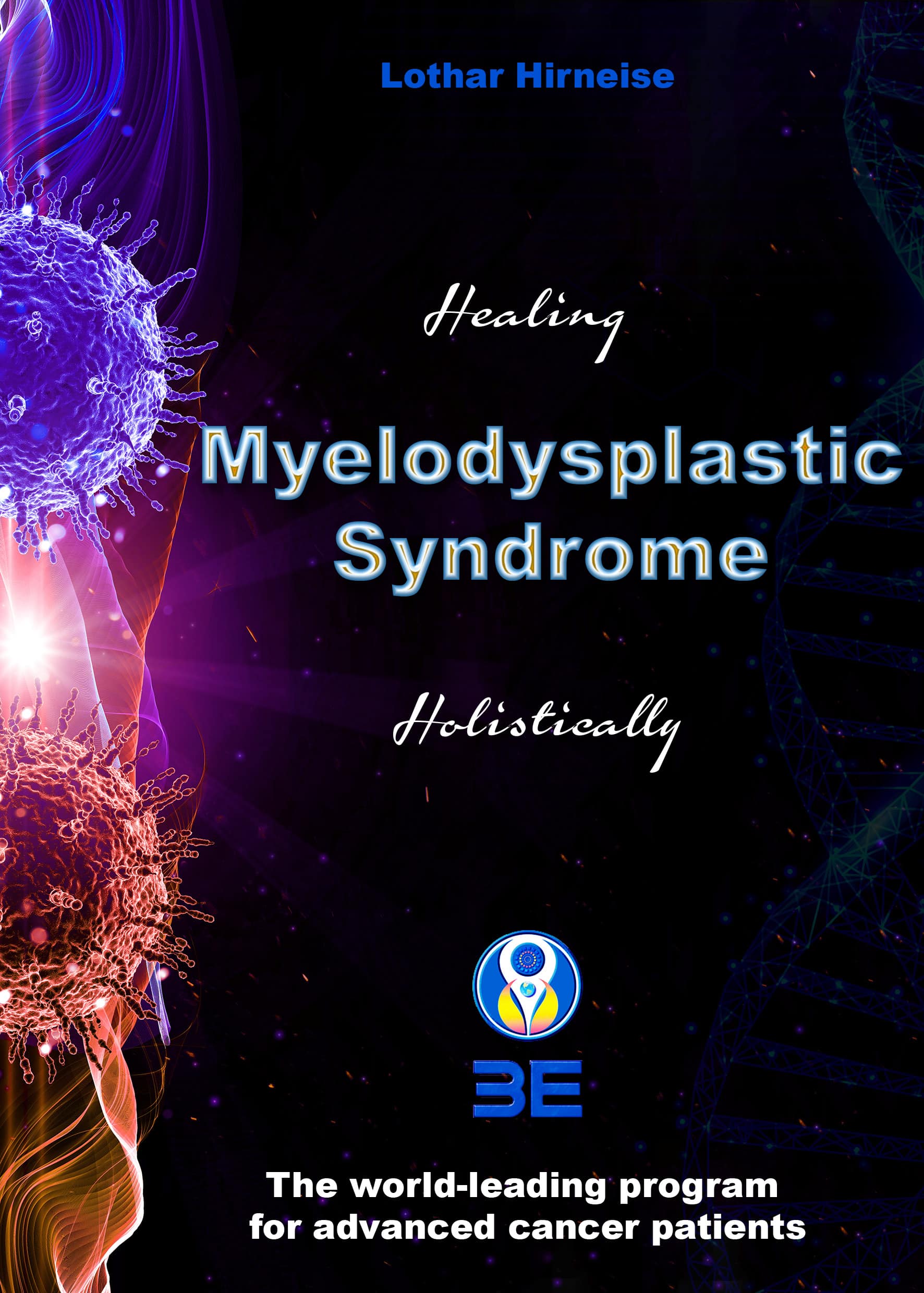 Myelodysplastic syndrome 