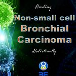Non-small cell bronchial carcinoma