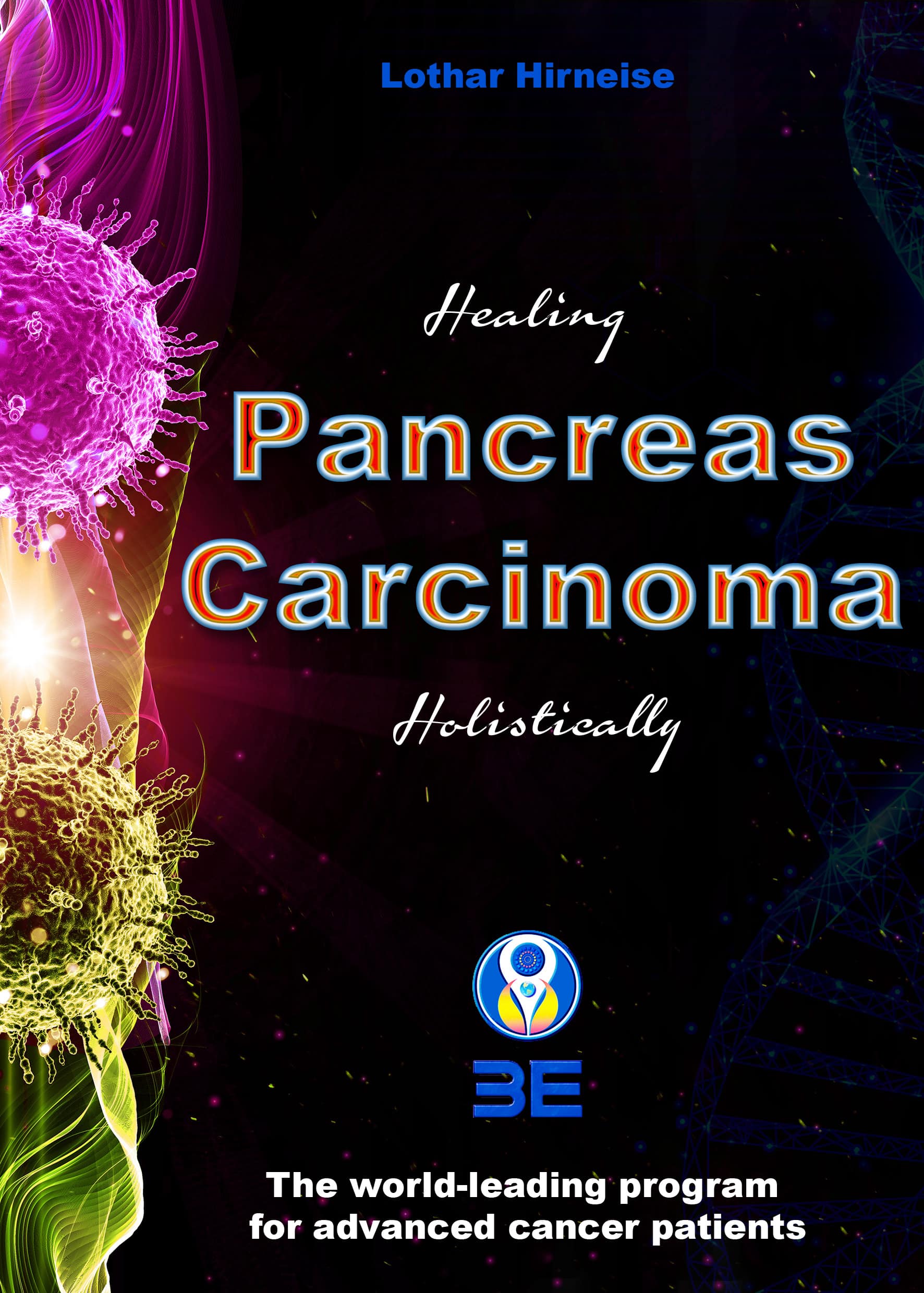 Pancreas carcinoma
