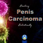 Penis carcinoma