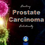 Prostate carcinoma
