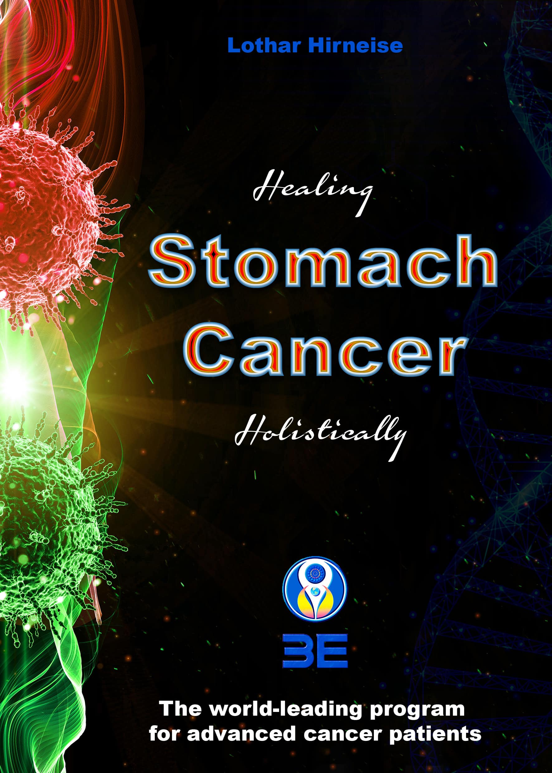Stomach cancer