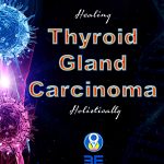 Thyroid gland carcinoma