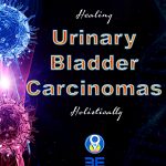 Urinary bladder carcinomas